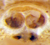 Mecaphesa epigynum (ventral)
